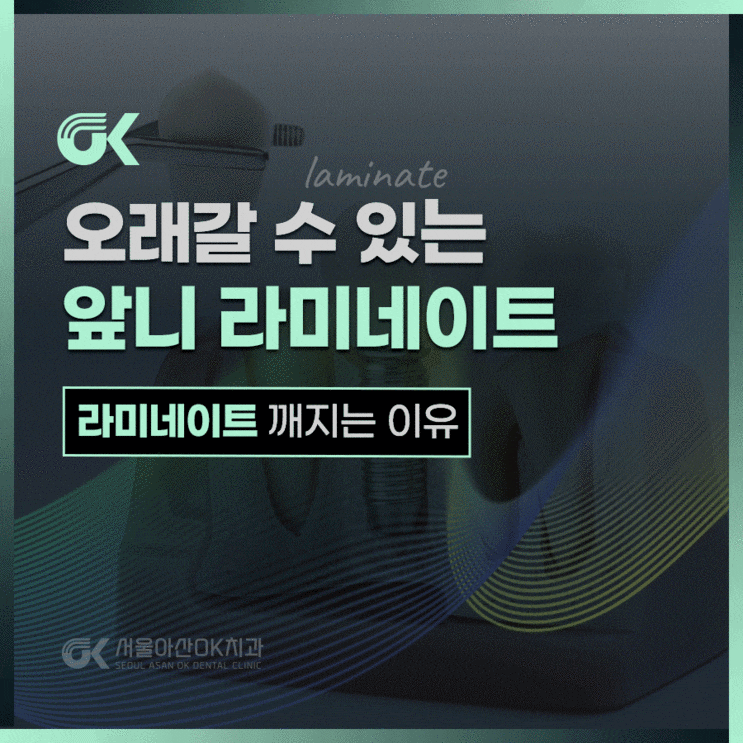  하남시치과, 앞니 라미네이트 깨짐 왜 생길까?