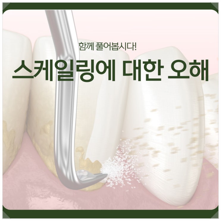  스케일링에 대한 오해, 함께 풀어봅시다!