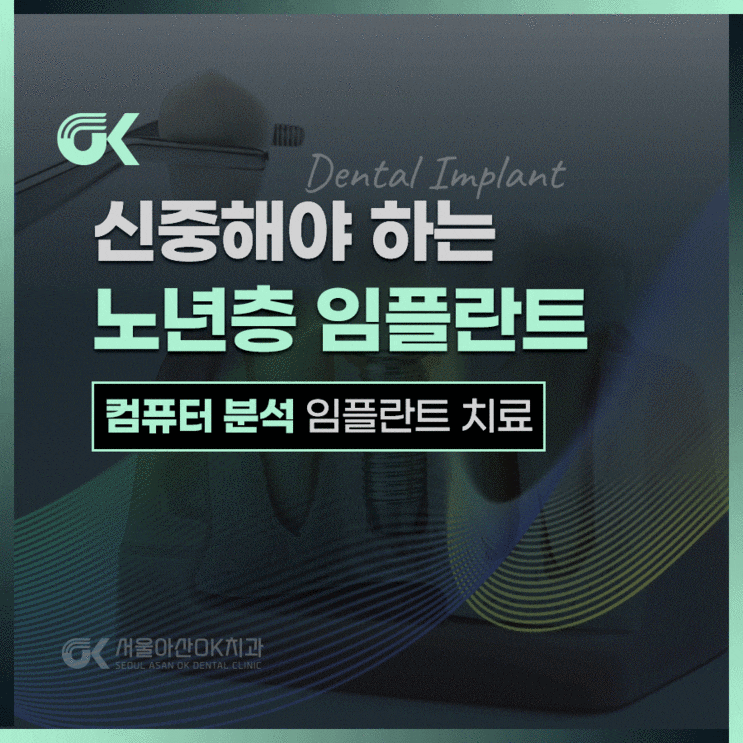  하남시 치과, 노년층 임플란트는 신중하게