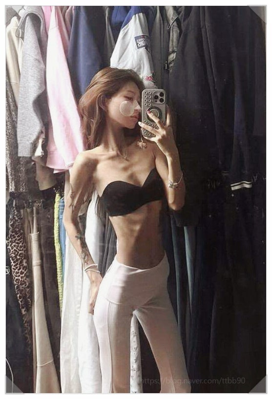  최진실 딸 최준희 또 칼댔다 수술 7일차 눈 밑 멍 공개 충격 폭탄 발언까지