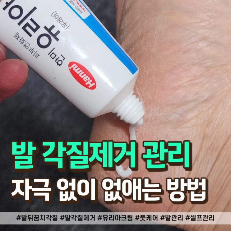  발 뒤꿈치 각질 자극 없이 없애는 유리아 연고 사용후기