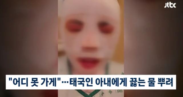 태국인 <b>아내 얼굴</b>에 <b>끓는 물</b> 뿌린 한국인 남편 폭행 폭로