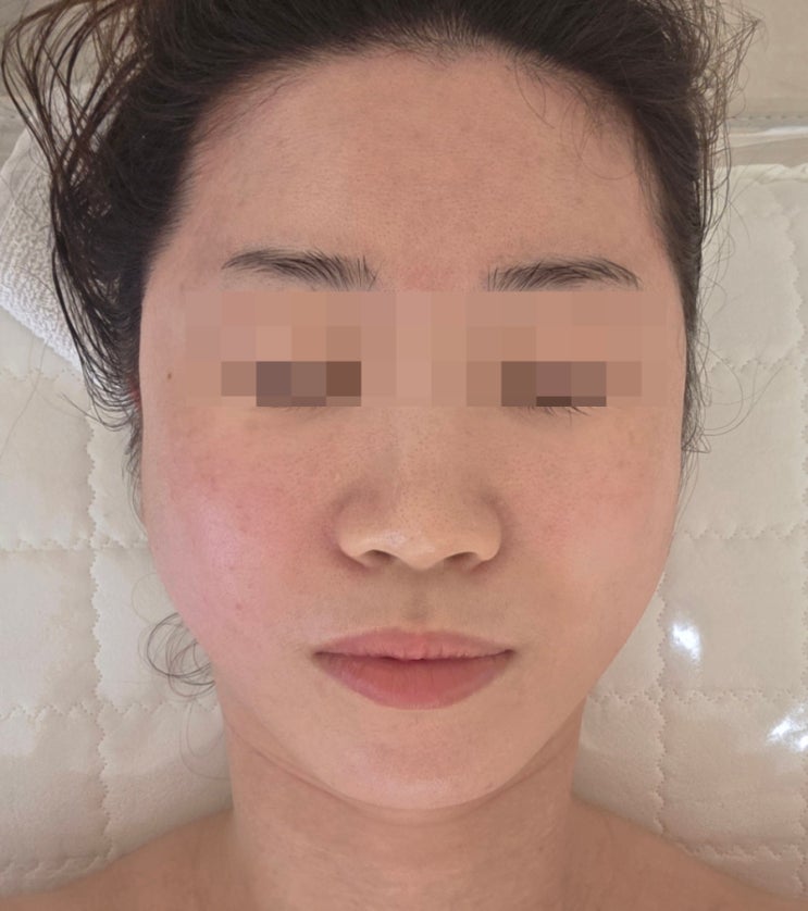  송도 피부관리 에스테틱 추천 수기관리로 이렇게까지 달라진다니 피아레스테 윤곽관리 후기
