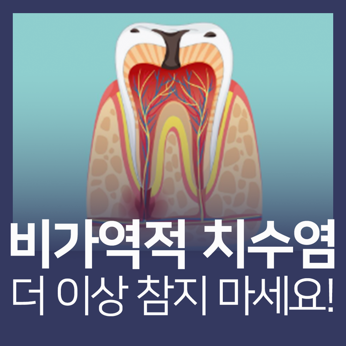 비가역적 치수염 증상, 이 통증이면 신경치료를 피할 수 없습니다