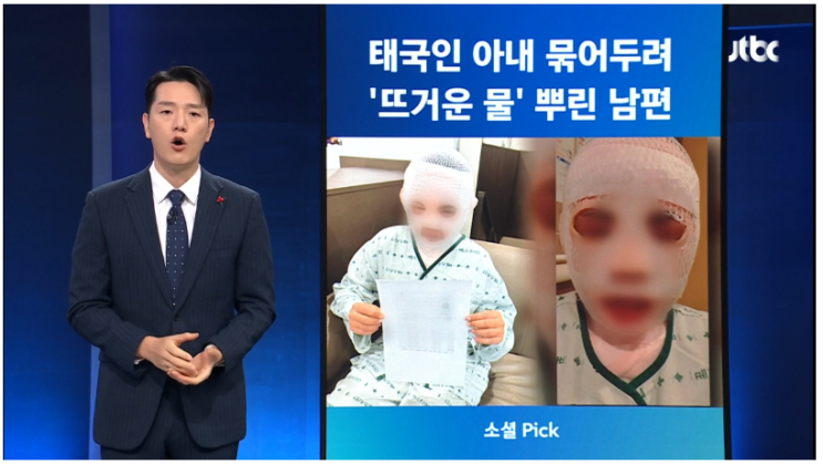 한국인 남편에게 <b>끓는 물</b> 폭행 <b>태국인</b> 여성 얼굴 화상<b>사건</b>... 