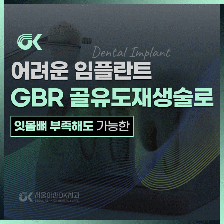  양평치과의원, GBR(골유도재생술)이란?