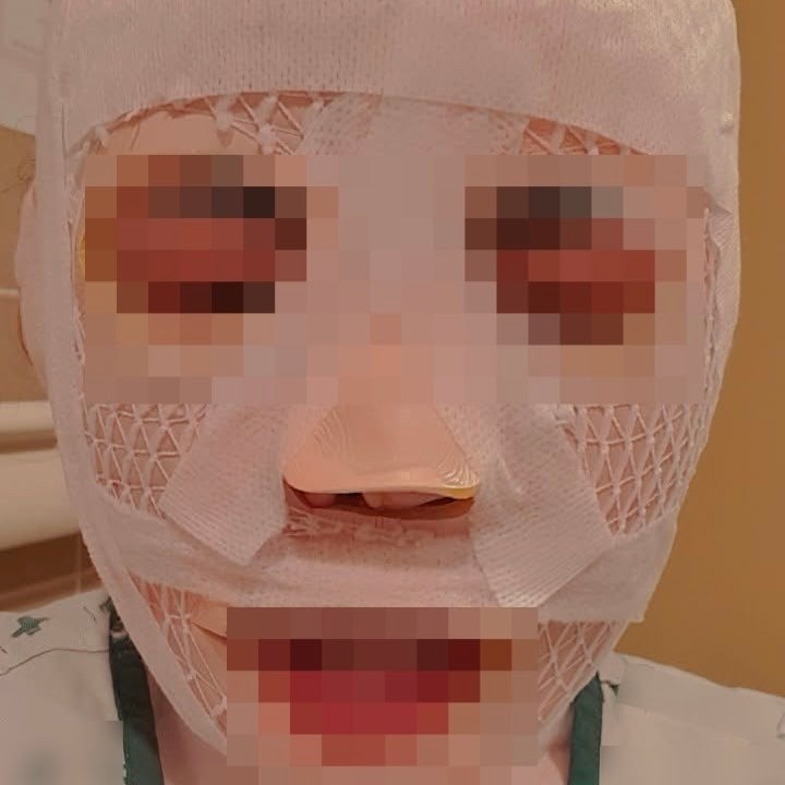 <b>태국인 아내</b>(여성) 폭행 가정폭력 <b>사건</b>! 이유? 얼굴에 <b>끓는 물</b>... 