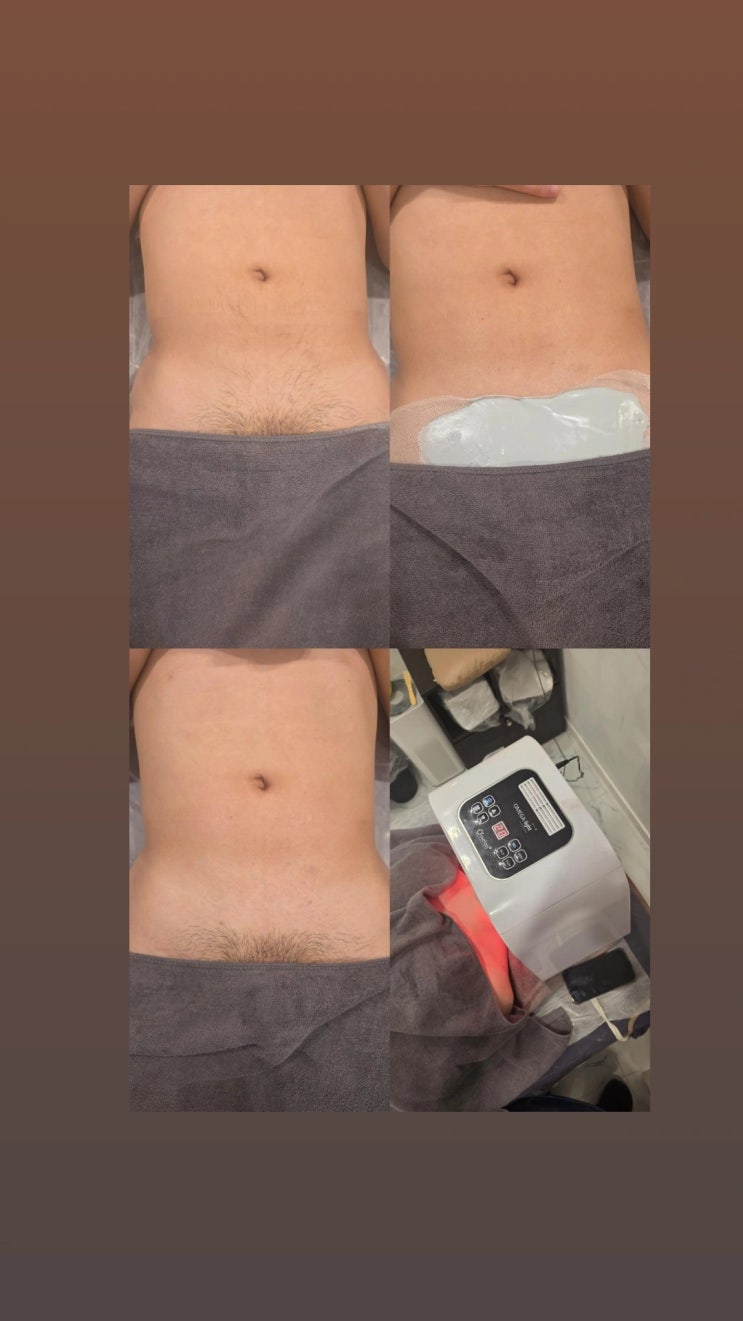  고객 맞춤 남자 브라질리언 왁싱, 영등포 남자 왁싱샵 "청춘케어"