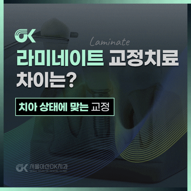  미사 강변 치과, 교정치료와 라미네이트 나에게 맞는 치료는?