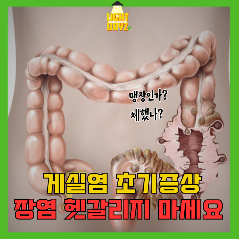 30대 여성 게실염 초기증상 3가지! 입원 수술 만큼은 피하세요 ft. 유산균 필수