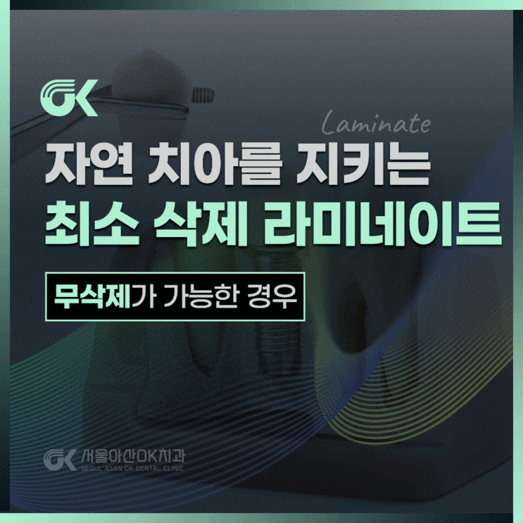 미사치과추천, 최소 삭제 라미네이트가 가능한 경우