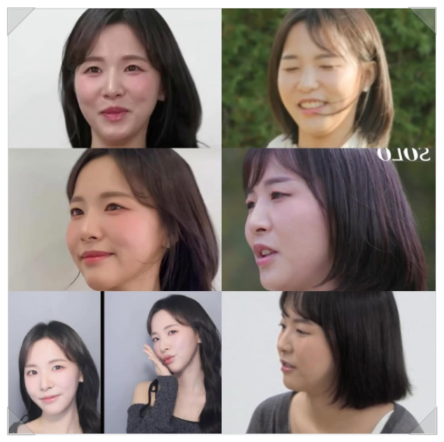 문래동피부과 탄력 올려주는 올타이트 리프팅