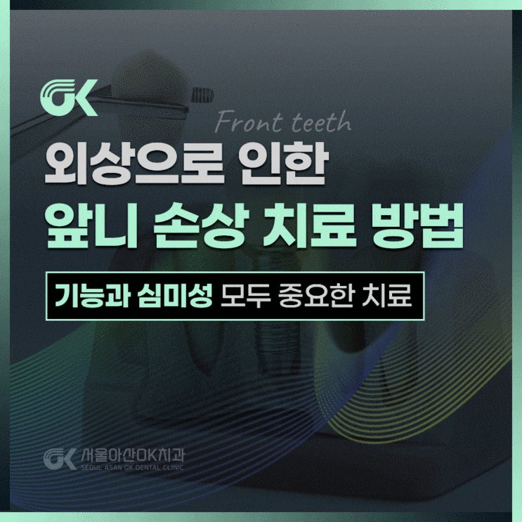  양평치과, 앞니 손상에 필요한 치료는?