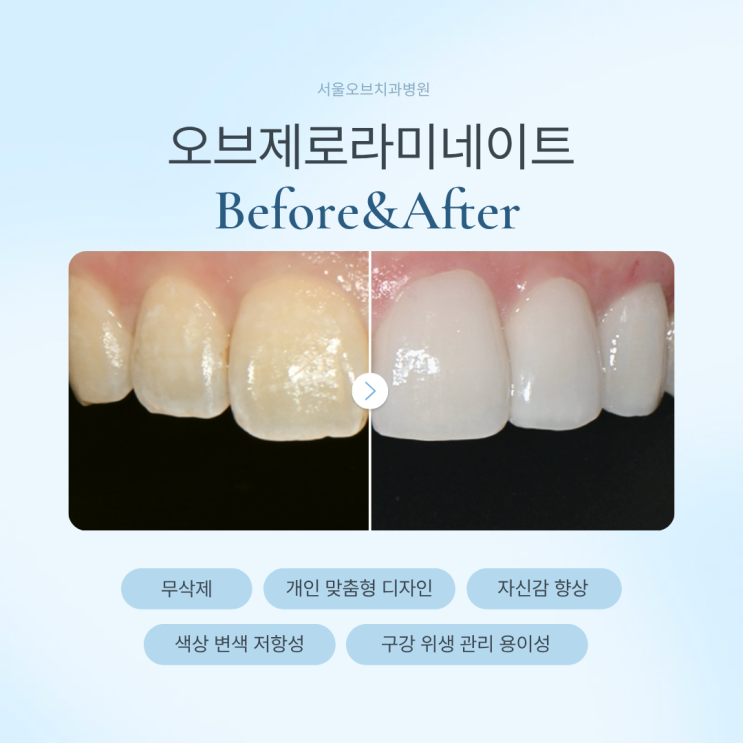  라미네이트 가격 비교 전 꼭 알아야 할 기준｜오브제로
