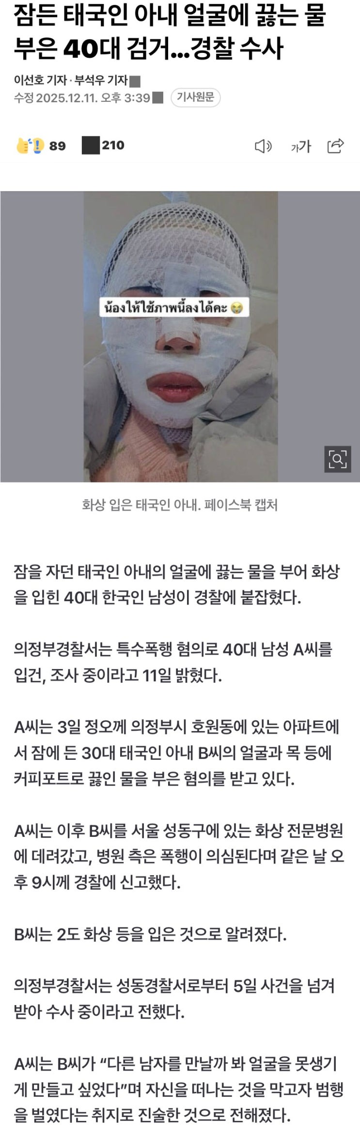 태국인 <b>아내</b> 얼굴에 <b>끓는 물</b> 부은 한국남자