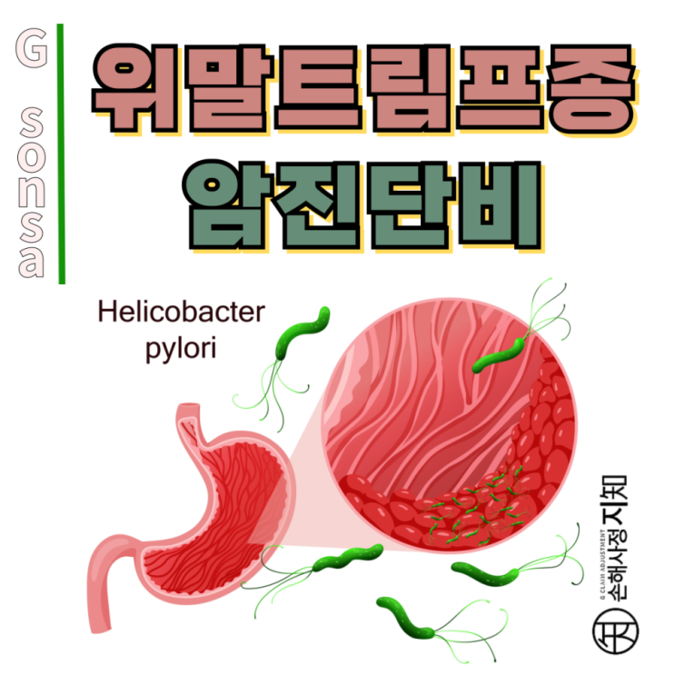  C88 위말트림프종 증상 – 보험사는 왜 거절할까? 일반암·고액암 받는 확실한 방법