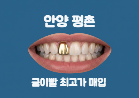  안양 평촌 금거래소 금이빨 폐금니 매입하는 곳 최고 가격!
