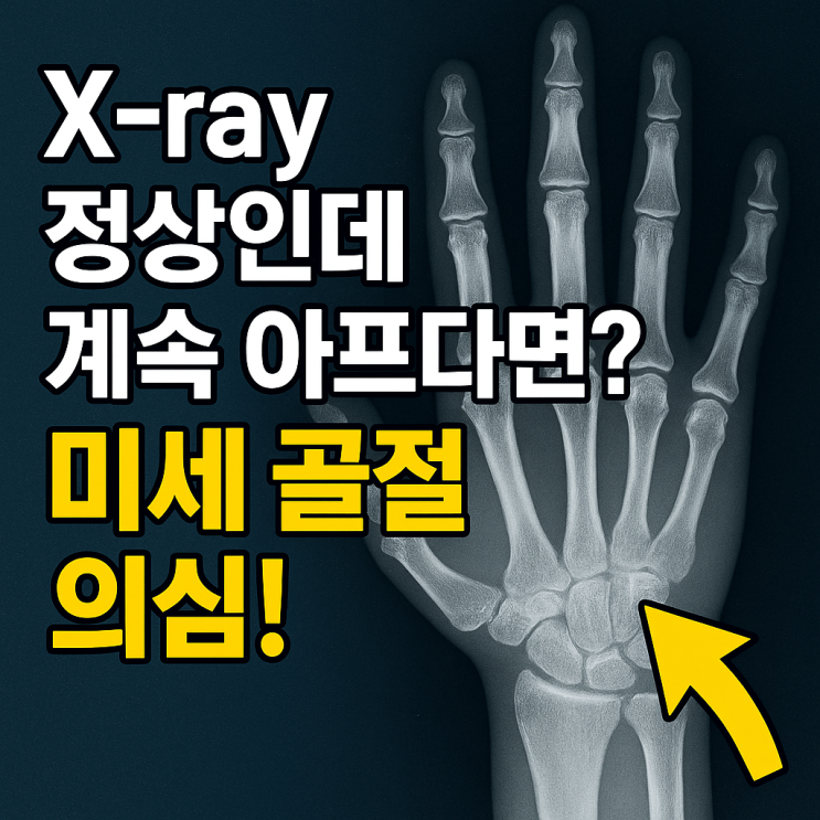 외상 후 계속 아픈 이유? ‘미세 골절’ 놓치면 회복이 더 늦어집니다