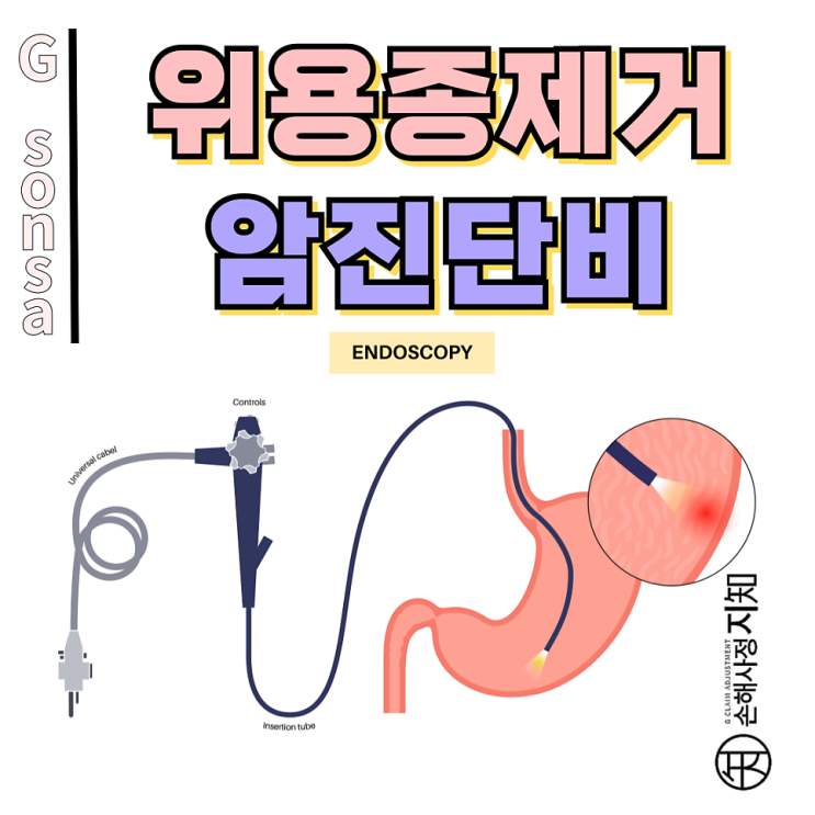  위용종 제거 후 D13.1만 믿으면 위험! 제자리암진단비 가능성 완전정리