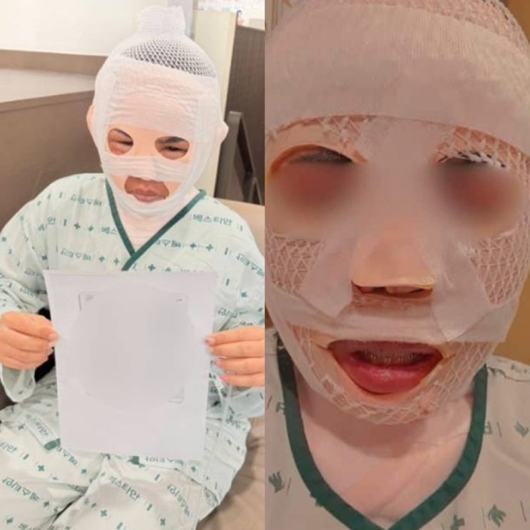 남자 못 만나게"… 잠자던 <b>태국인 아내</b> 얼굴에 '<b>끓는 물</b>' 테러
