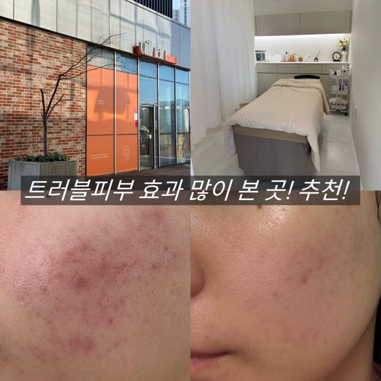  창원 피부관리 중동 유일한 에스테틱 트러블 전 후 비교