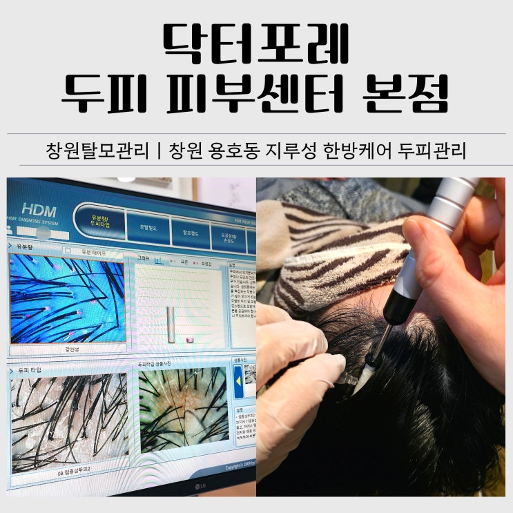  창원탈모관리 추천｜닥터포레 두피 피부센터 본점 지루성 한방케어 후기