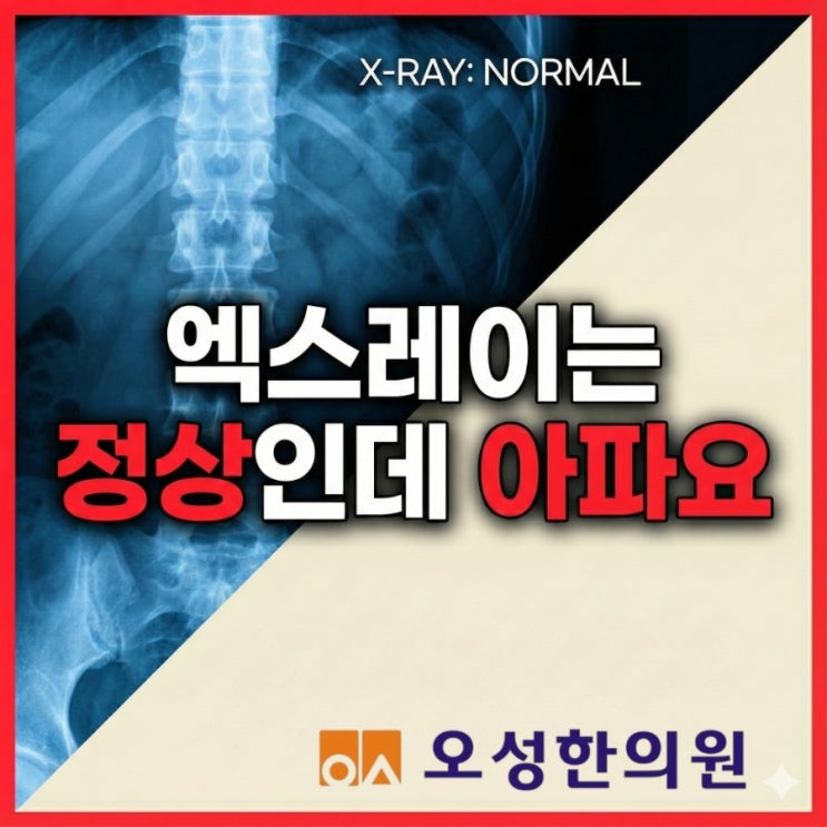  엑스레이는 정상인데 아파요, 파주 봉일천 교통사고 한방병원