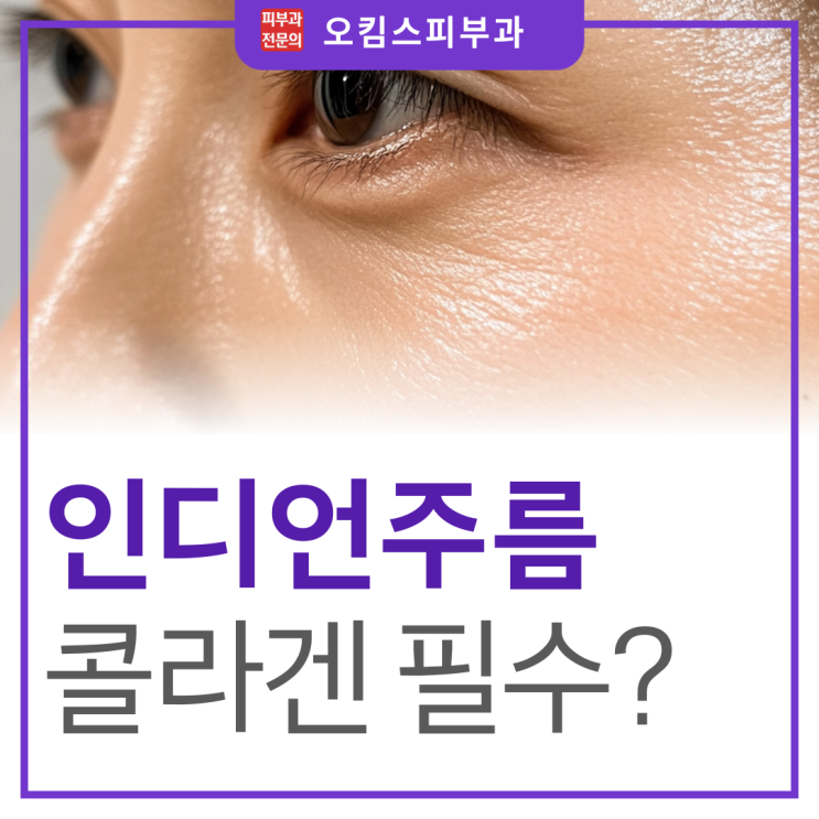  주엽동 피부과 눈밑 인디언주름 제거, 콜라겐이 중요한 이유?