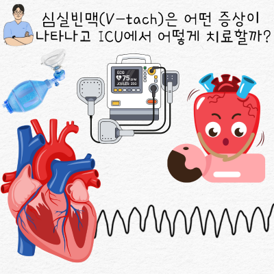 심실빈맥(V-tach)은 어떤 증상이 나타나고 ICU에서 어떻게 치료할까?