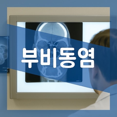 부비동염 전염, 축농증 전염 가능성?