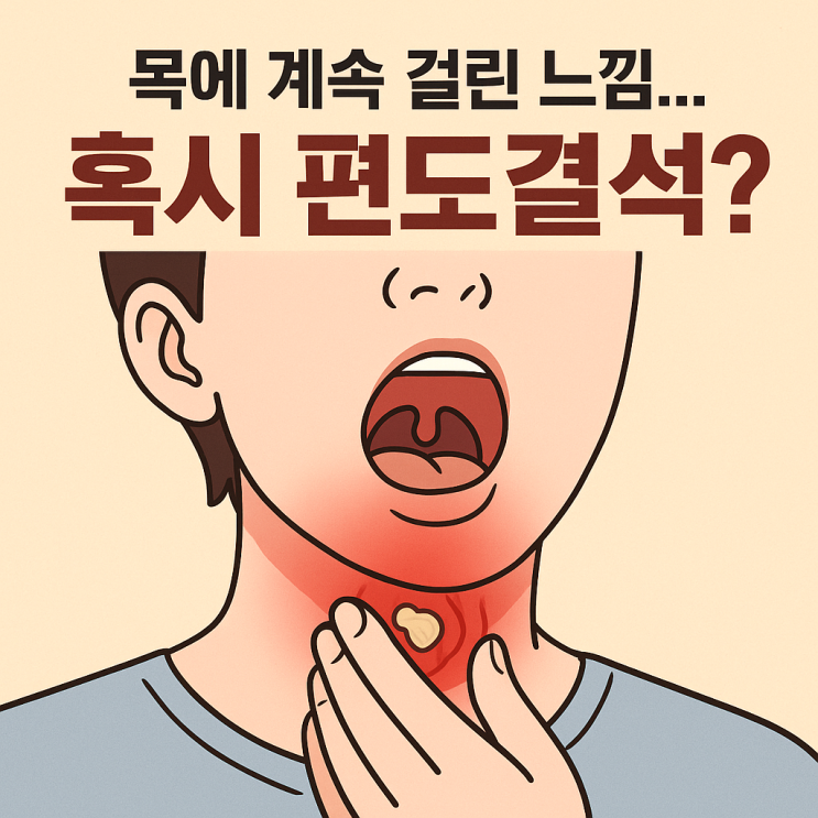   목 이물감이 계속된다면? 편도결석 의심 신호 총정리