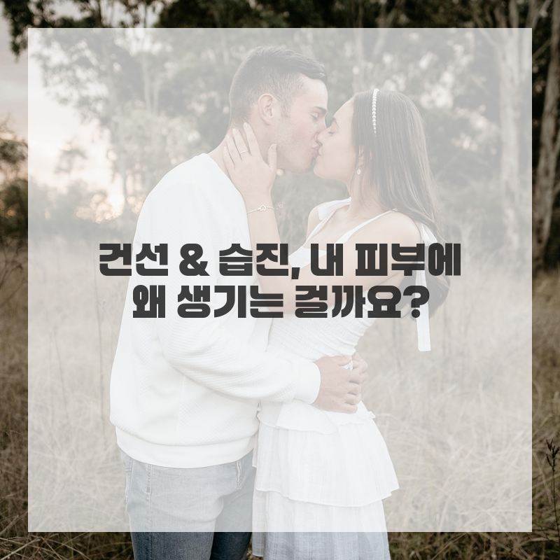 끈적임 대신 산뜻함! 건선습진, 대전 피부과 전문의와 함께하는 나만의 관리법