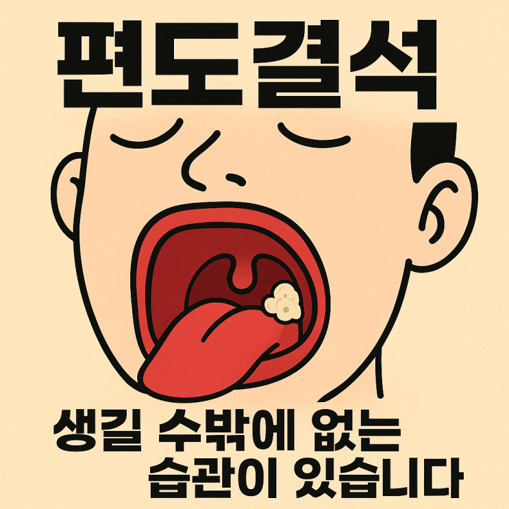   편도결석이 잘 생기는 사람의 공통된 생활습관｜혹시 나도 해당될까?