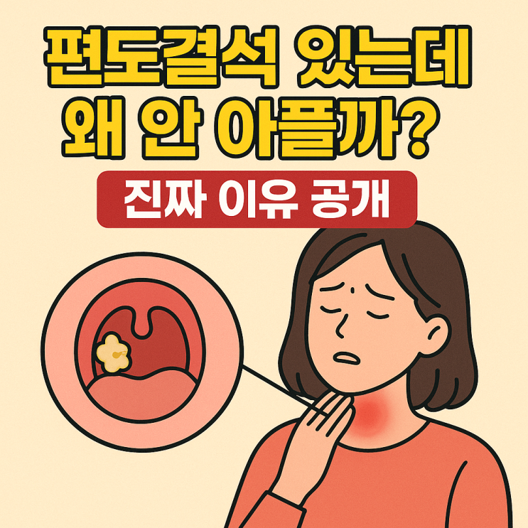   편도결석이 있어도 통증이 없는 이유｜아픈데 없는 게 정상입니다