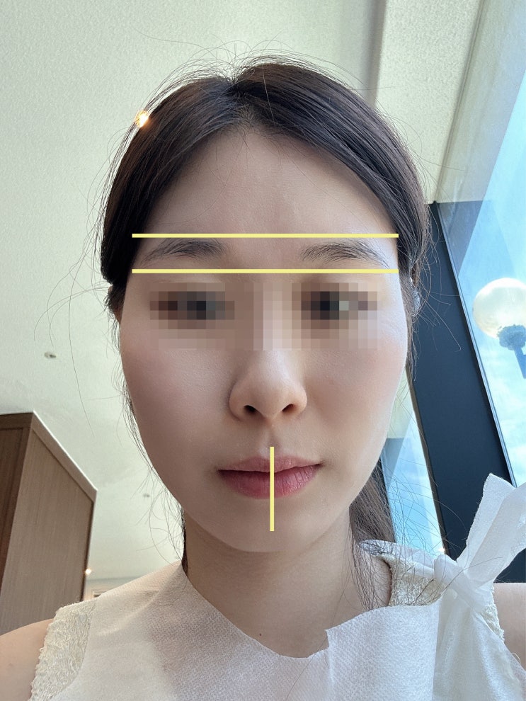  부산안면비대칭교정 위주로 하는 한의원 방문 후기