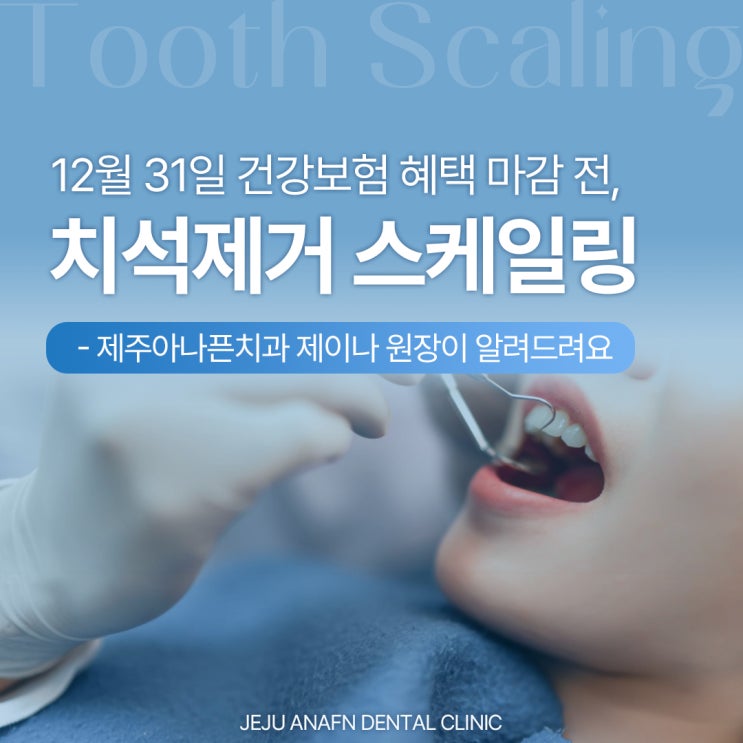  제주도치과 치석제거, 12월 31일 건강보험 혜택 마감전 확인하세요