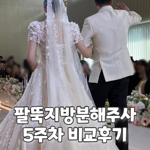  본식 준비하면서 팔뚝지방분해주사로 하프해진 신사비만클리닉 5회차 후기