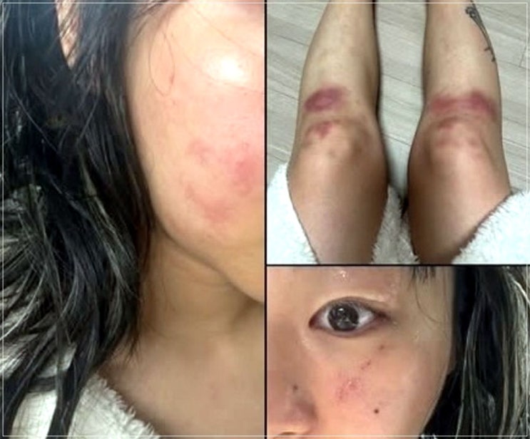 래퍼 <b>재키와이</b> 방달 <b>데이트 폭력</b> 주장…SNS 공개 후 소속사... 