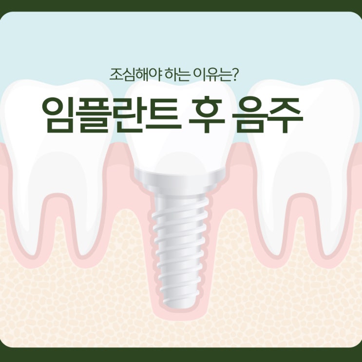  임플란트 후 음주, 조심해야 하는 이유는?