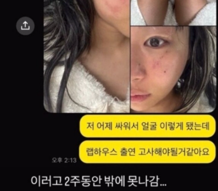 <b>재키와이 데이트 폭력 폭로</b>.. AOMG가 법적 지원 선언한 '전... 