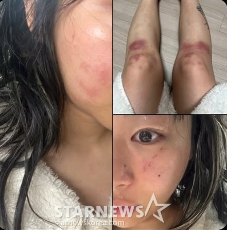 <b>재키와이</b>, 감금·폭행 주장 SNS 폭로로 드러난 <b>데이트 폭력</b>... 
