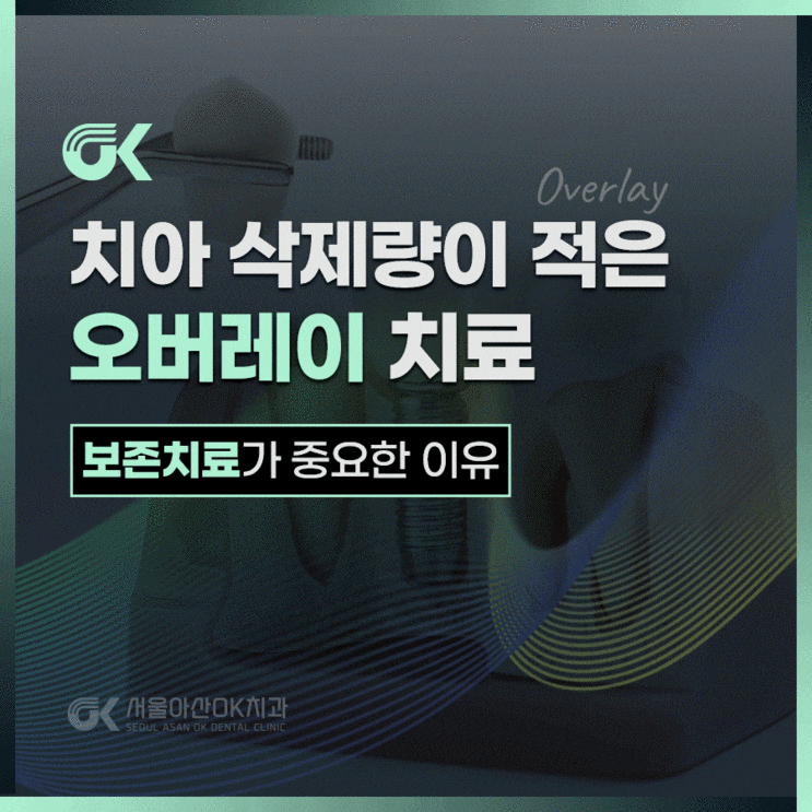  하남오버레이치과와 기존 크라운의 차이점은?