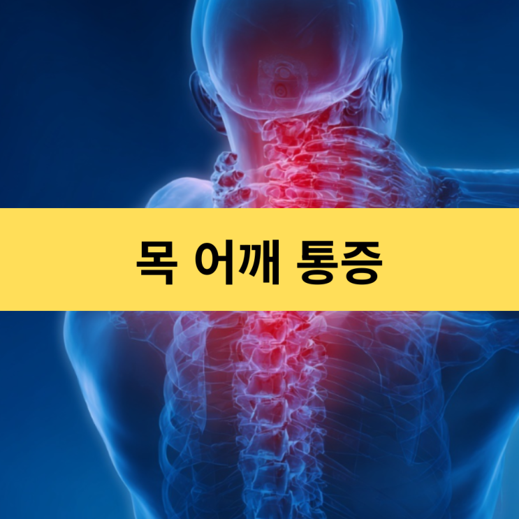  자고 일어나면 목 어깨 통증? 의심 질환 3가지와 관리법 | 오십견, 목디스크, 근막통증증후군