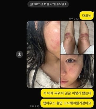 “살고 싶어서 알렸습니다”…<b>재키와이 데이트 폭력</b> 고백에... 