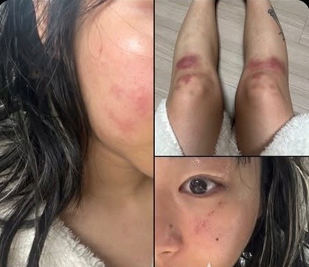 “사랑이 폭력이 되는 순간”…<b>재키와이</b>, <b>데이트 폭력</b> 피해... 