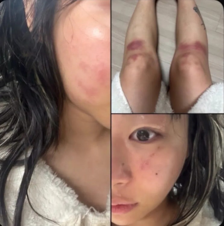 <b>재키와이 데이트 폭력</b> 방달로부터 폭행, 감금에 부엌 칼로 위협... 