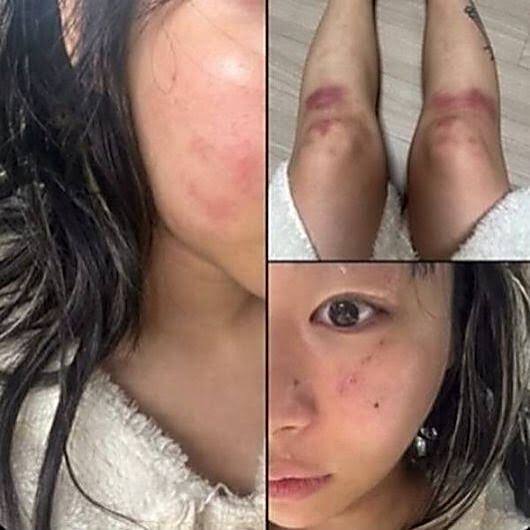 <b>재키와이 데이트 폭력 논란</b>, AOMG가 법적 대응 선언한 이유