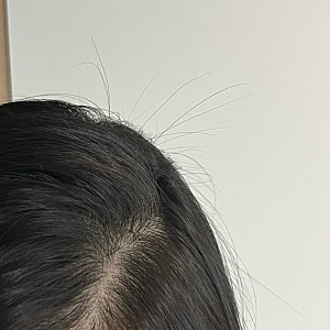바이브랩 헤어스칼프 인핸싱폼 내돈내산 3달 후기(다쓴공병, 재구매 의사는...?)