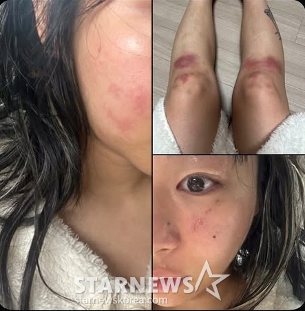 <b>재키와이 데이트 폭력</b> 주장 방달은 반박 법적으로 판단 기준은