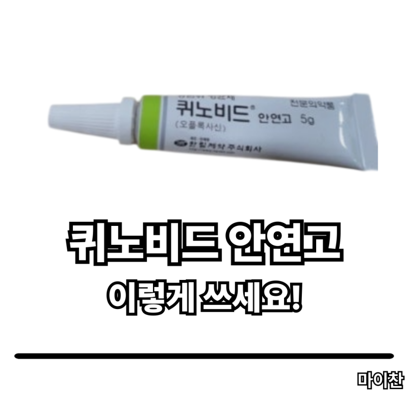 눈염증 욱신욱신할 때, 퀴노비드 안연고 이렇게 쓰세요